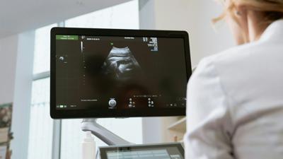 doctor-reviewing-ultrasound-image.jpg