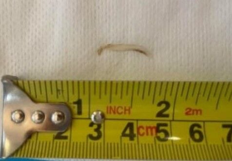 Choked on a fish bone? You might have a case, court says | Newsletter ...