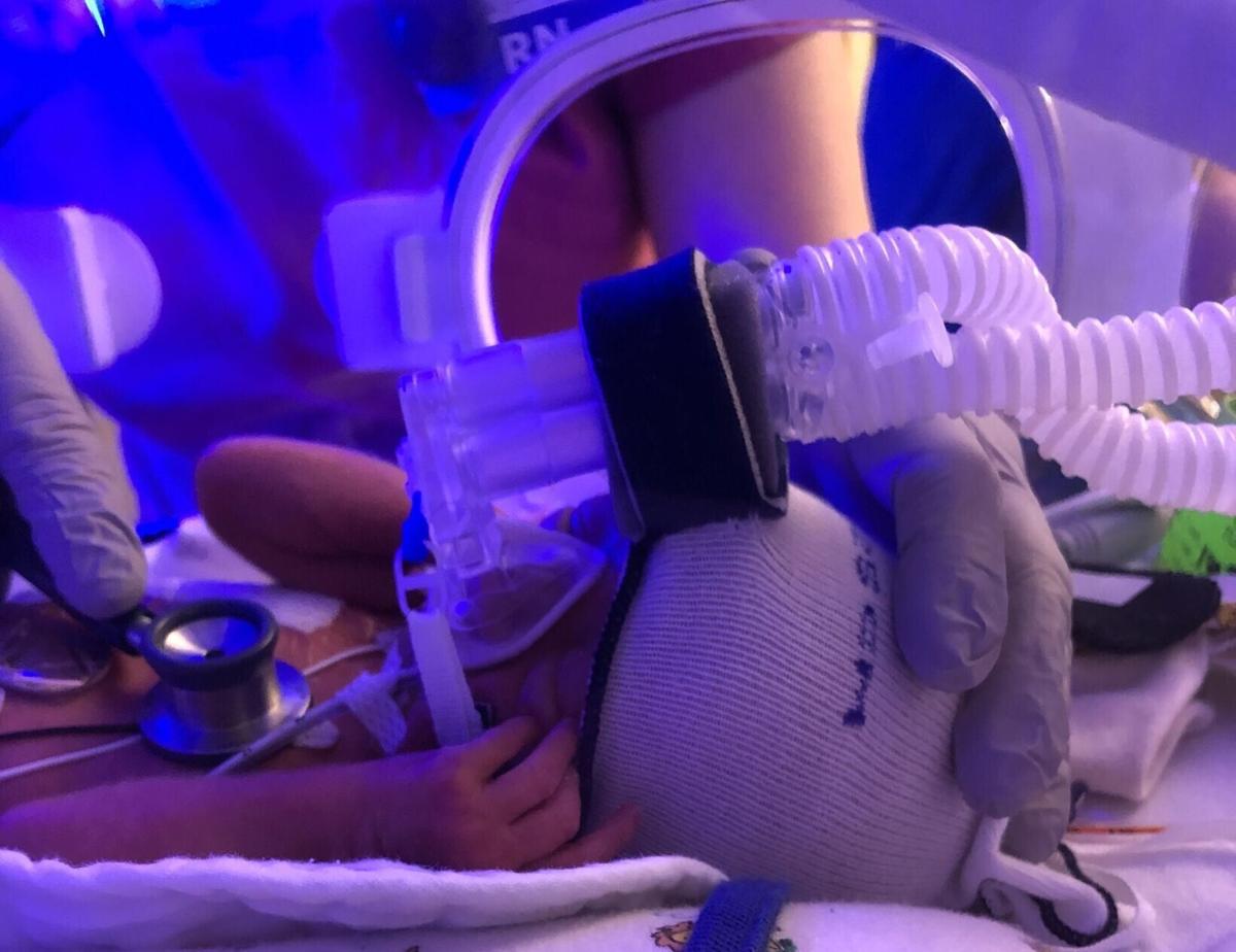 COPYRIGHT RESTRICTED NICU baby