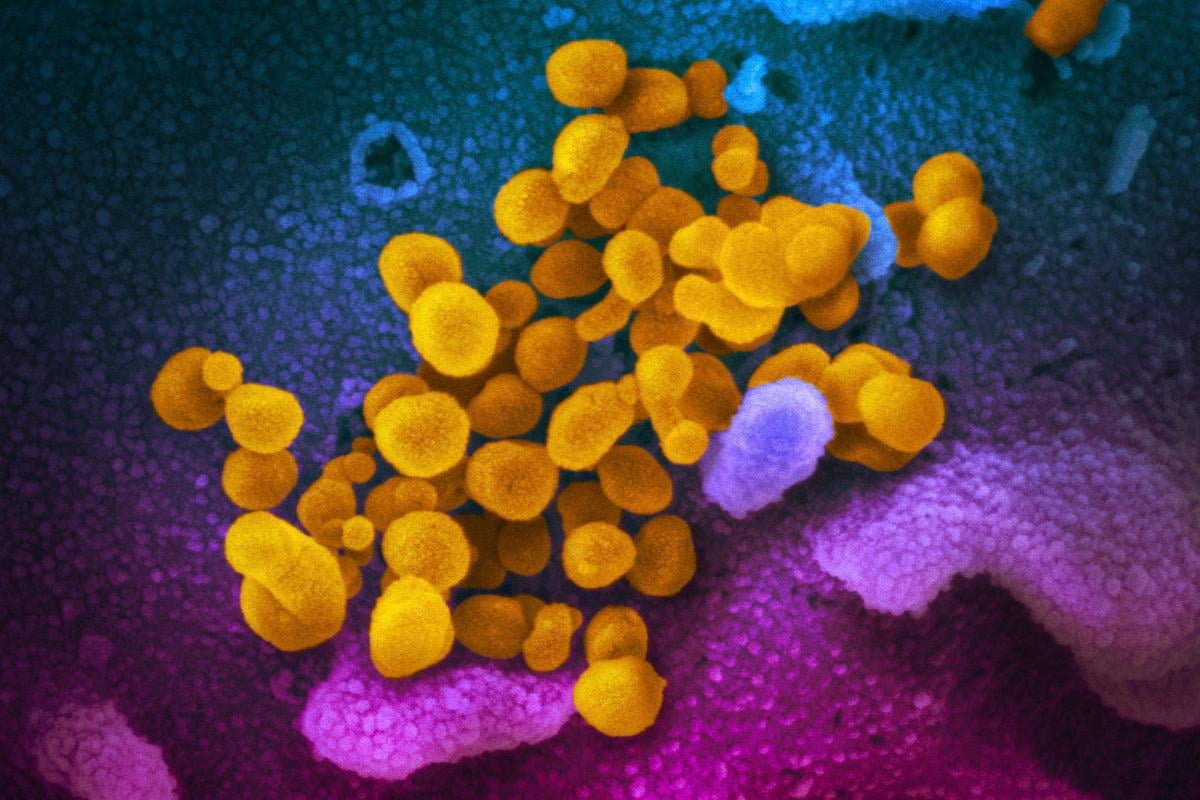 COVID-19 virus