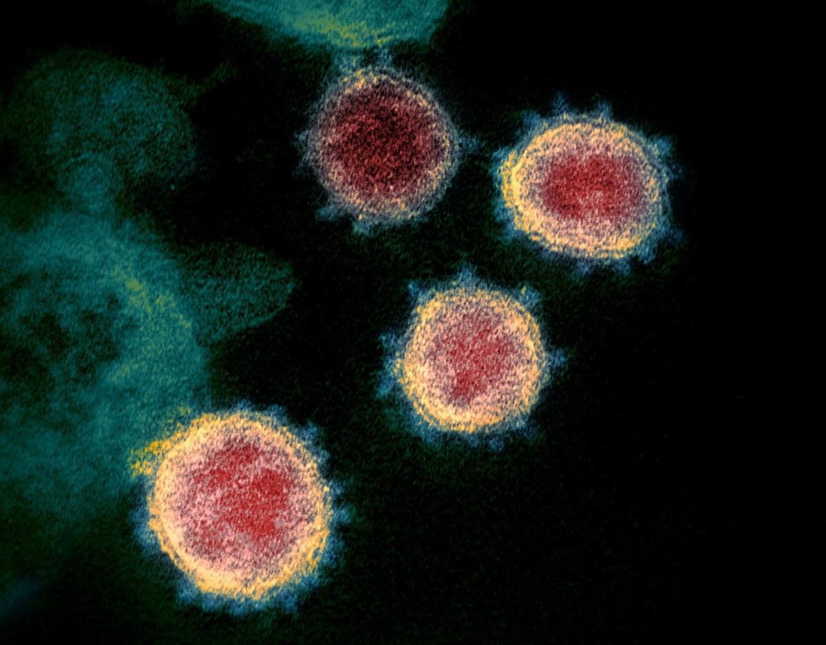 Clinical trial begins in US to test possible coronavirus treatment