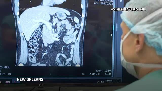 Miss. dad gives daughter lifesaving organ donation ...