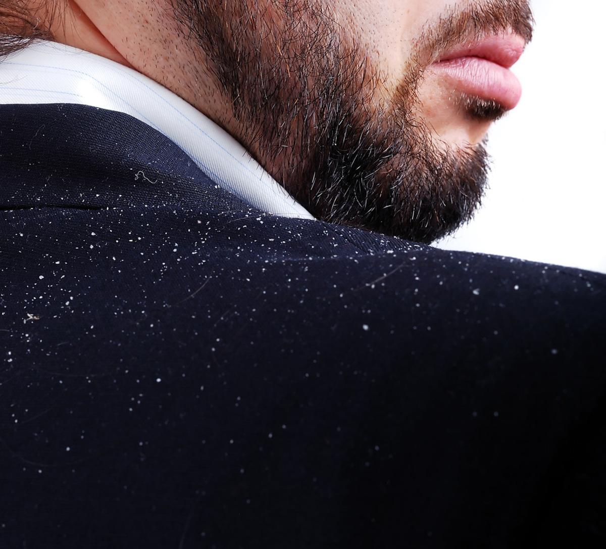LIFE HEALTH-DANDRUFF MYO