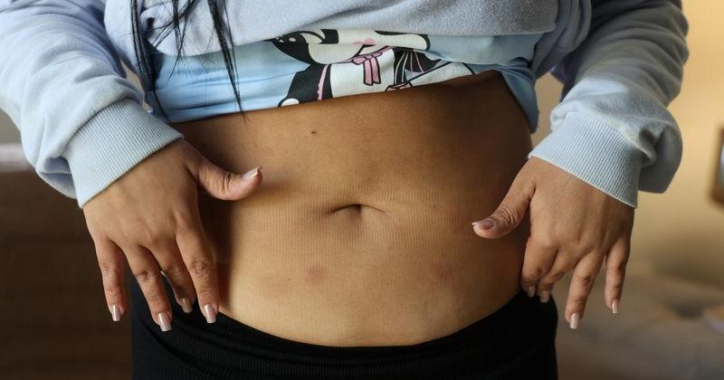 Booming weight-loss drug demand in Brazil fuels smuggling, theft and health fears | Top News