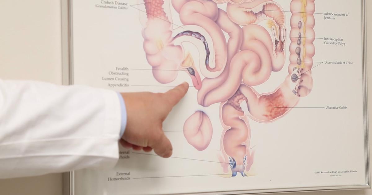 Appendix Blue Blue Sky Science: What's the purpose of the appendix?