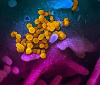 COVID-19 coronavirus