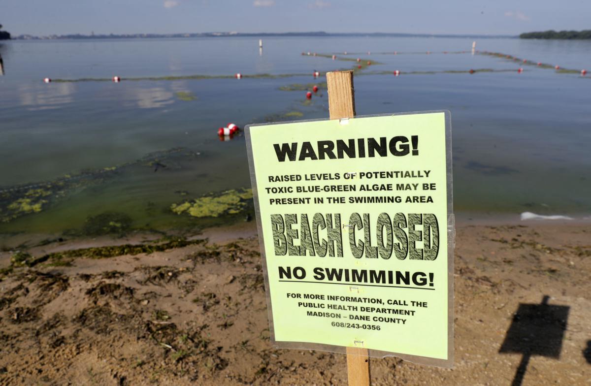 Three Madison beaches closed due to bacteria and bluegreen algae
