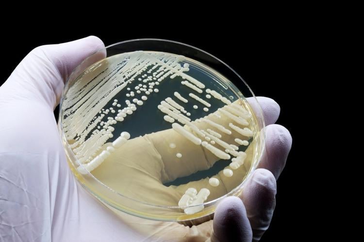 UW–Madison researchers identify therapeutic target for dangerous fungal infections
