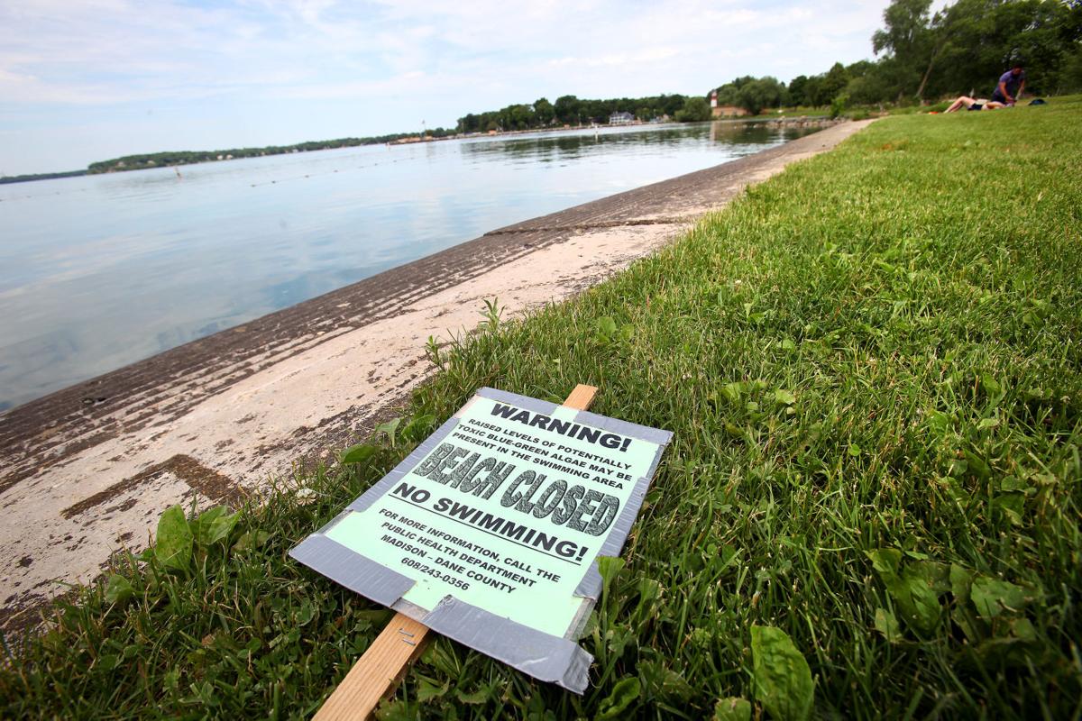 Water pollution