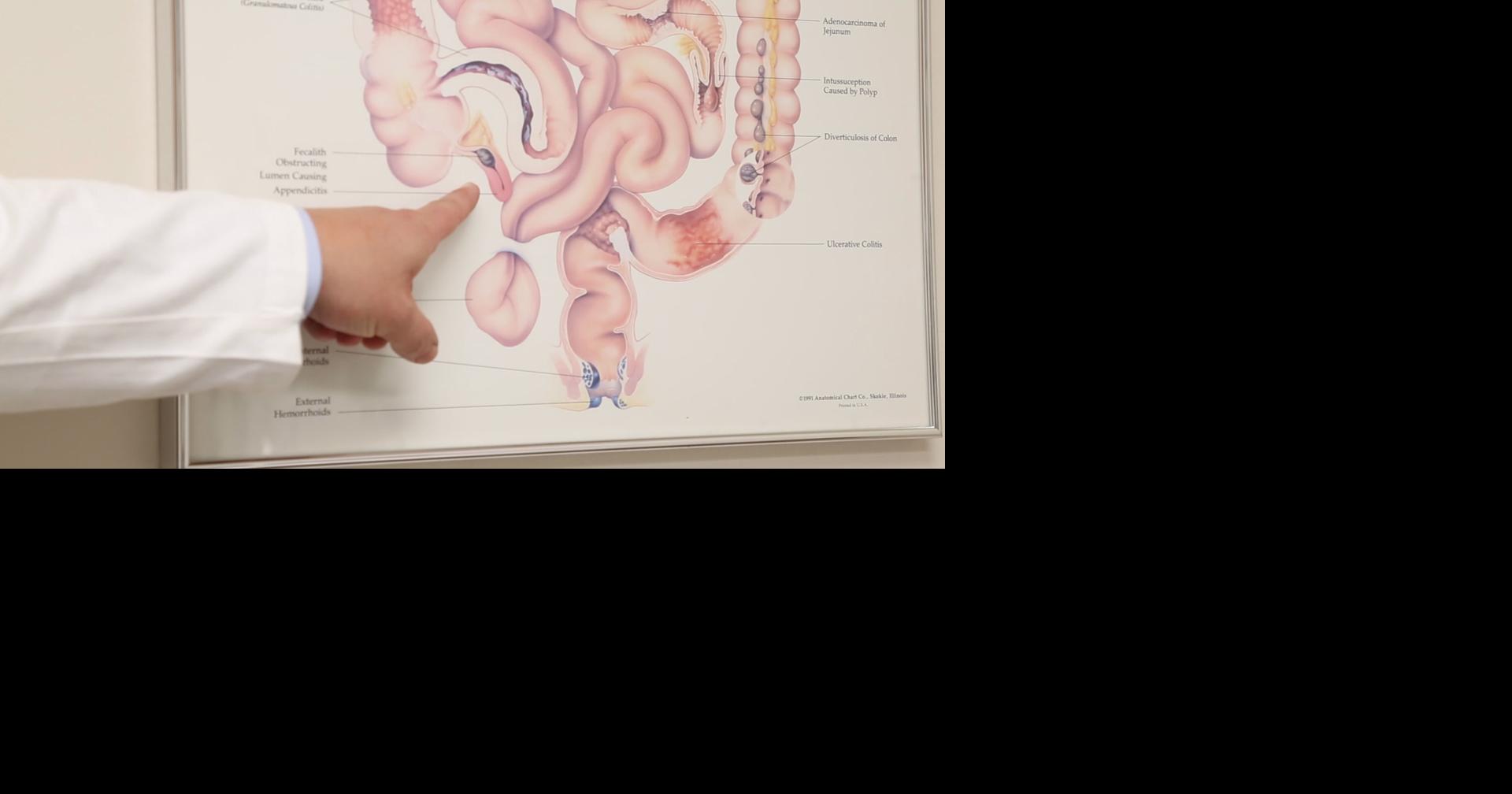 Blue Sky Science: What's the purpose of the appendix?