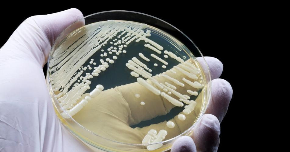 UW–Madison researchers identify therapeutic target for dangerous fungal infections