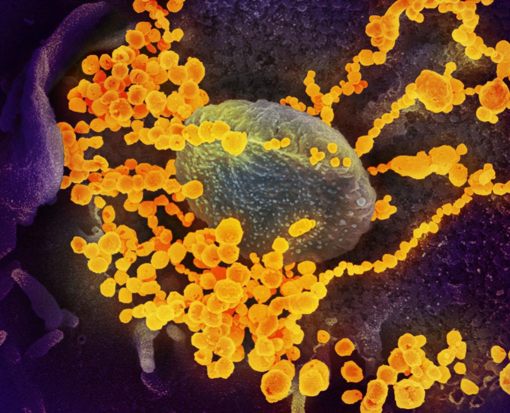 Covid 19 Virus Samples In Dane Milwaukee Counties Differ Uw