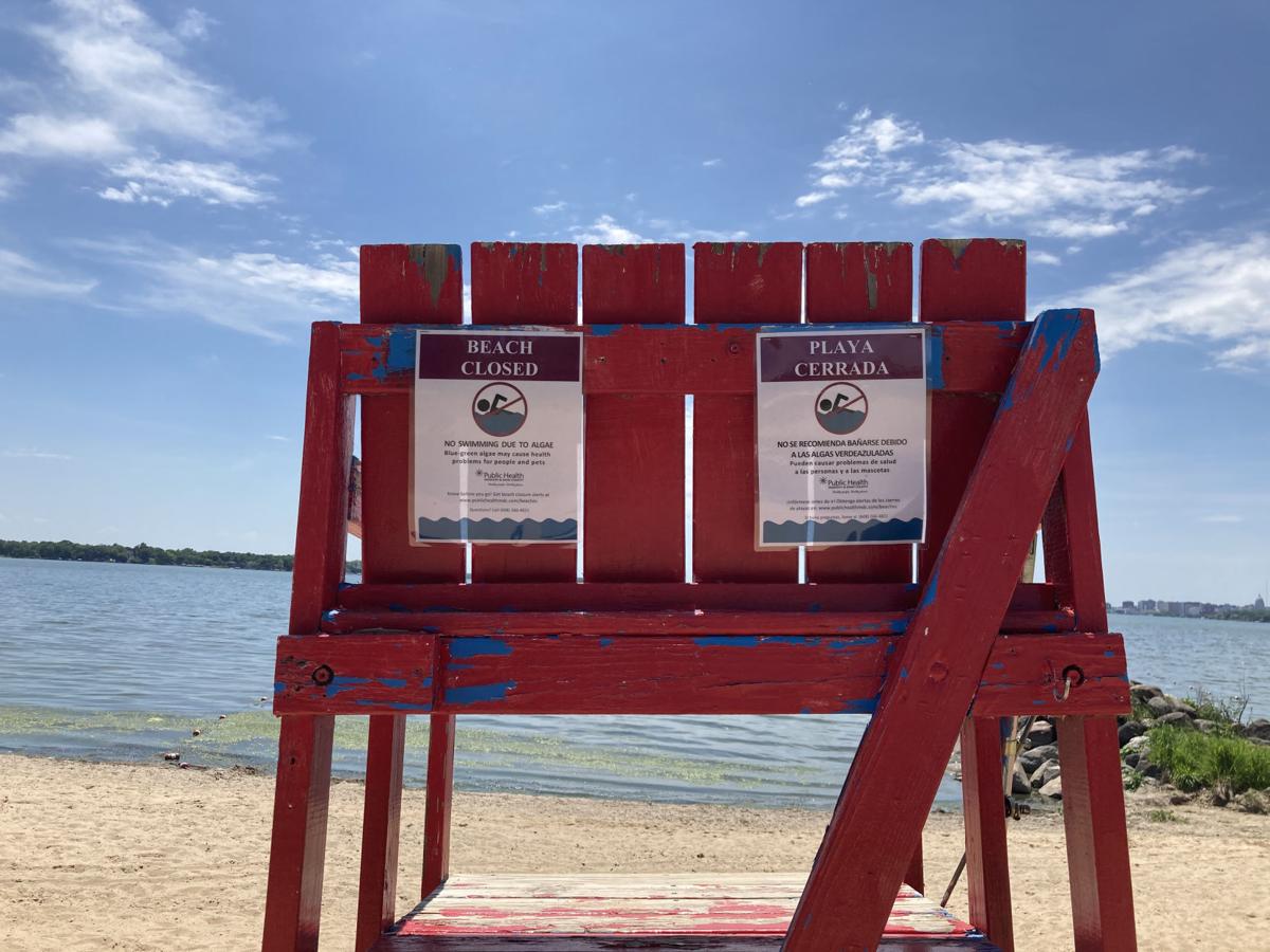 Watch Now 5 Madison Area Beaches Closed Due To Hazardous Blue Green Algae Science Environment Madison Com