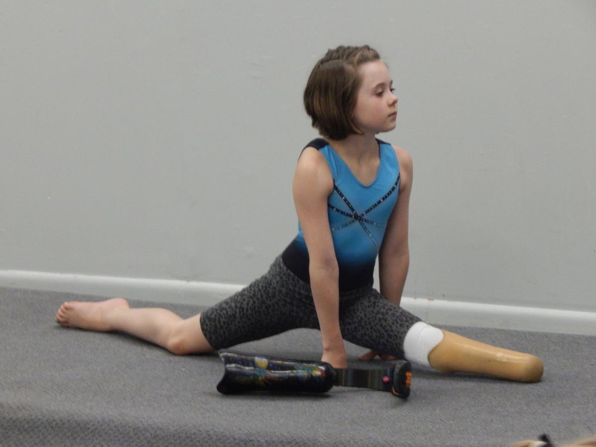 Zoe mostly wears her prosthetic, although she takes it off during gymnastics classes for some of the stretching exercises because it isn't as flexible as the human body.