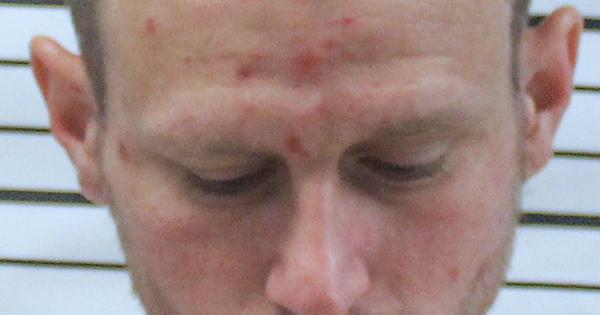 Madison man charged with abuse of 18-month-old child | News ...