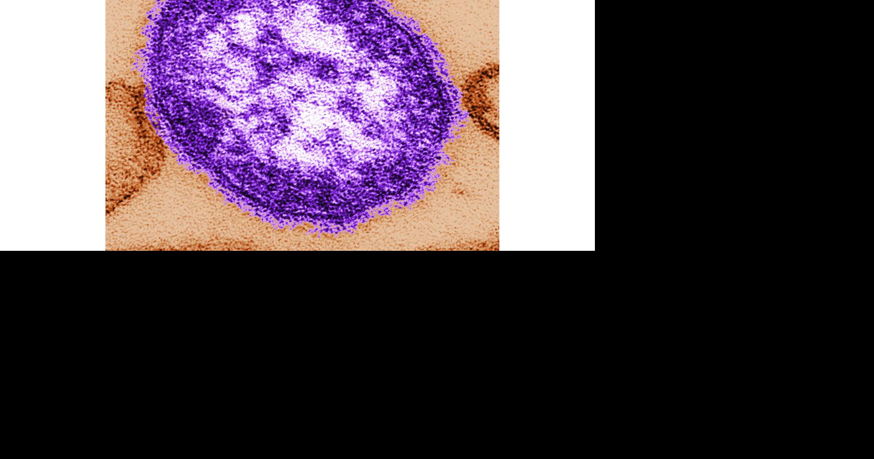 Coroner releases details of infants who died amid growing Pennsylvania measles outbreak A Pennsylvania coroner confirms that the two measles-related deaths in Pennsylvania last month involved infants, and the virus itself caused one of the deaths