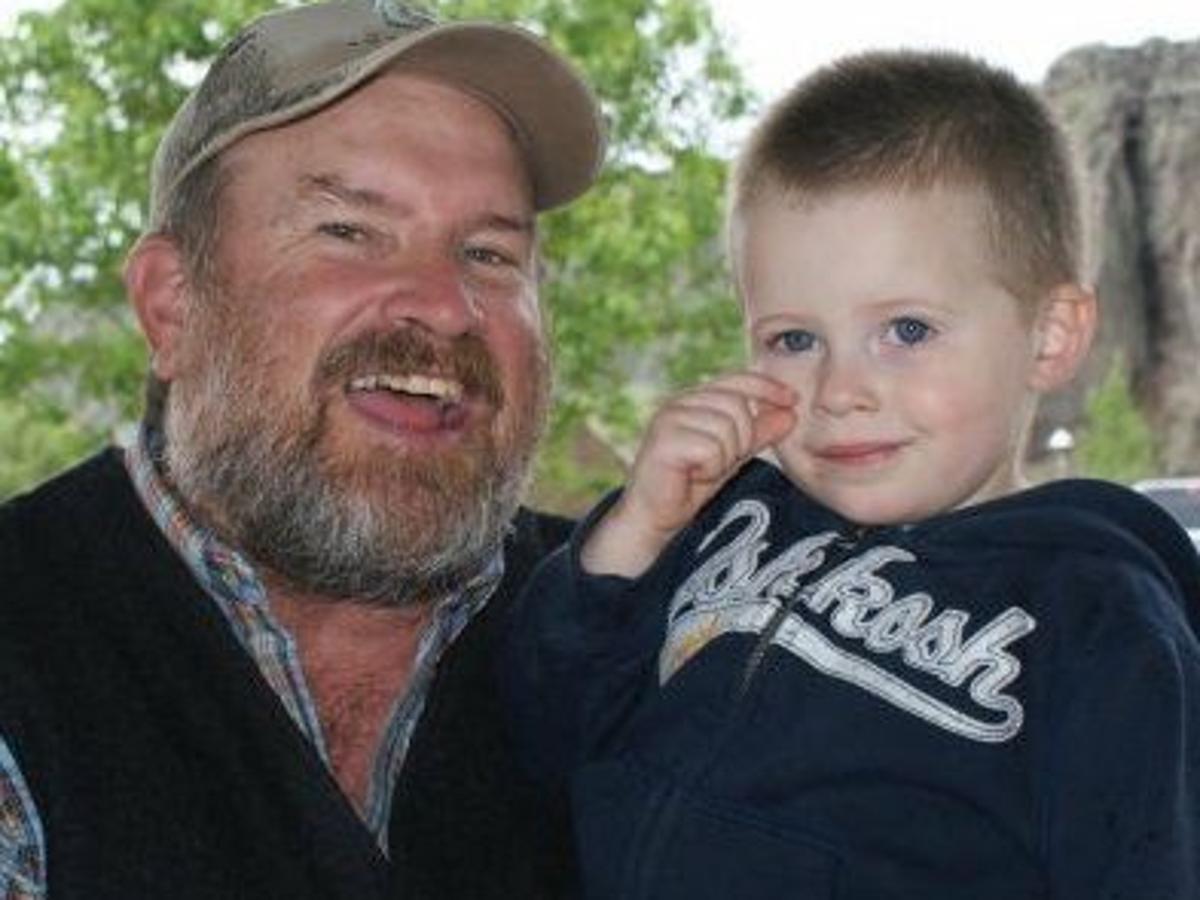 Burn Victim Faces Long Road To Recovery Local Magicvalley Com