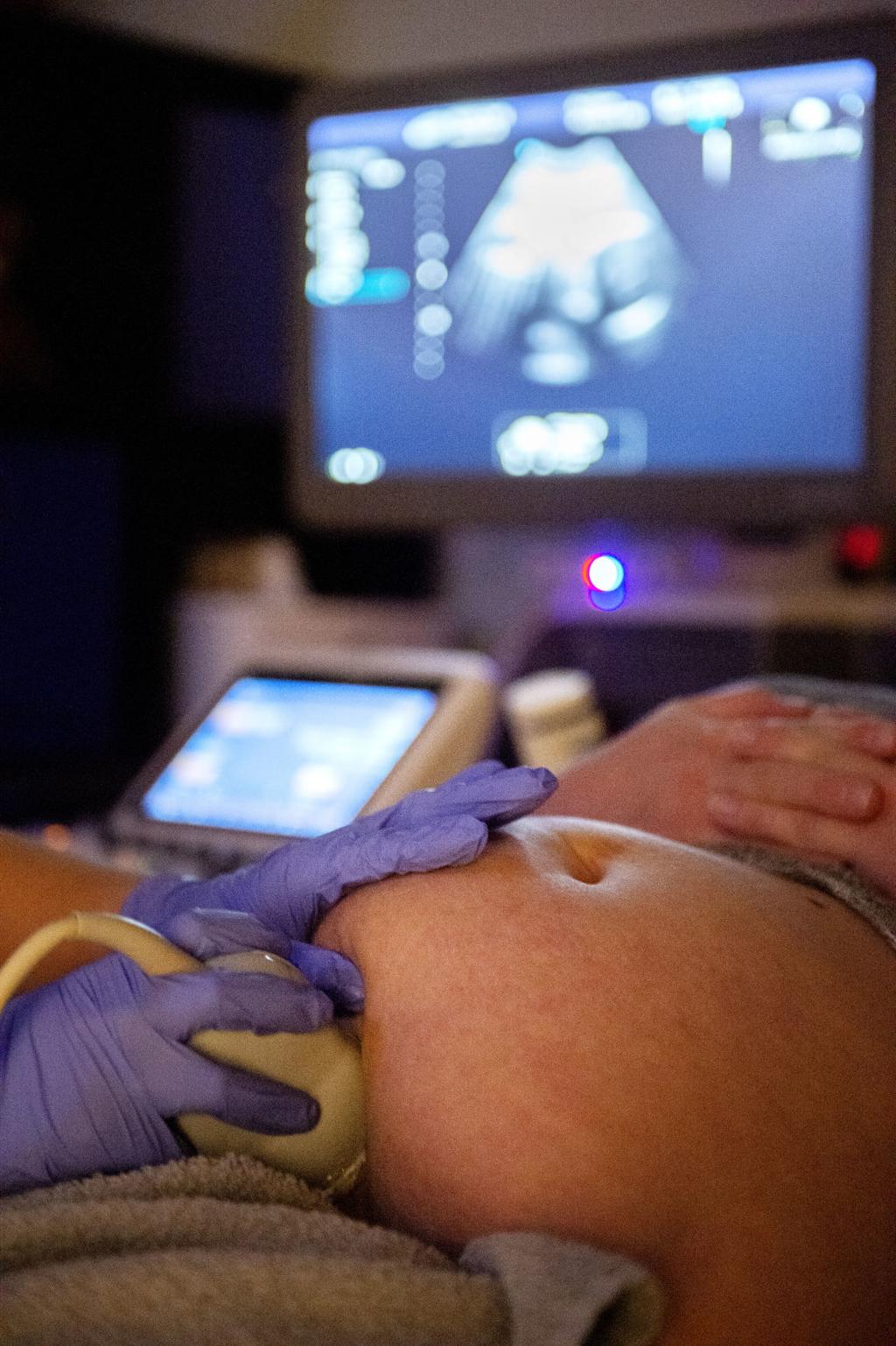 Want To Know The Sex Of Your Baby Earlier Twin Falls Has Elective