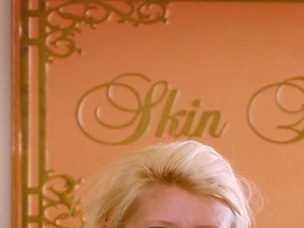 Botox Clients Have Market In Mankato Local News Mankatofreepress Com