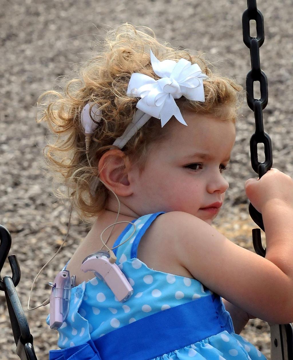 Cochlear Implants Help Kids Experience Hearing Local News