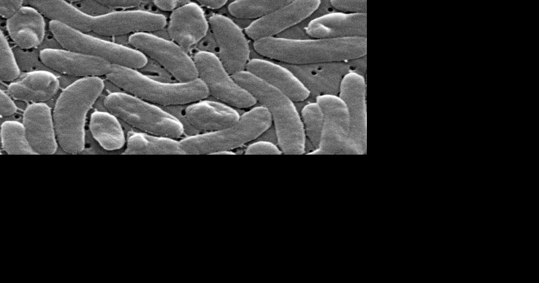 Health officials urge caution for Gulf Coast beachgoers during surge of deadly bacterial infections