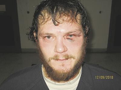 Police Conneautville Area Man Resists Arrest Assaults Law