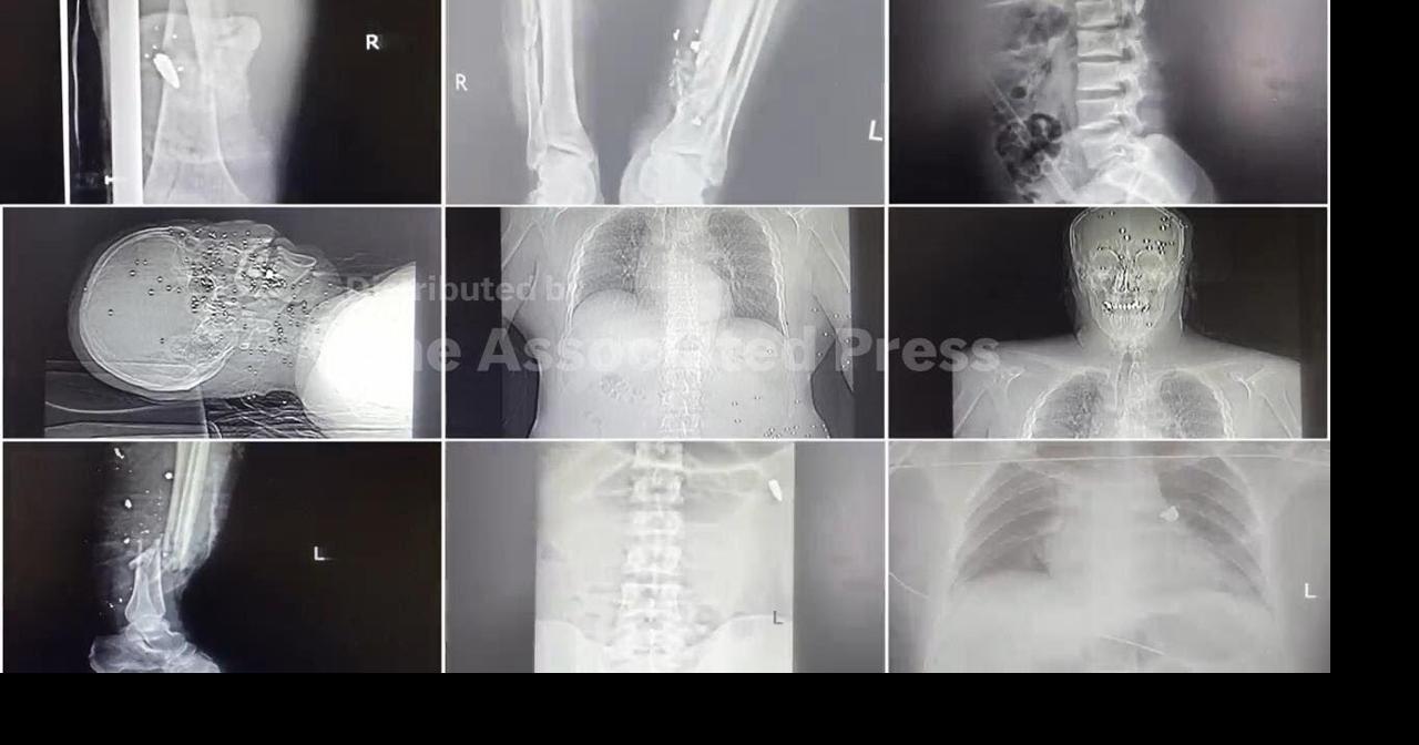 Iran security forces threaten staff at hospitals packed with protesters