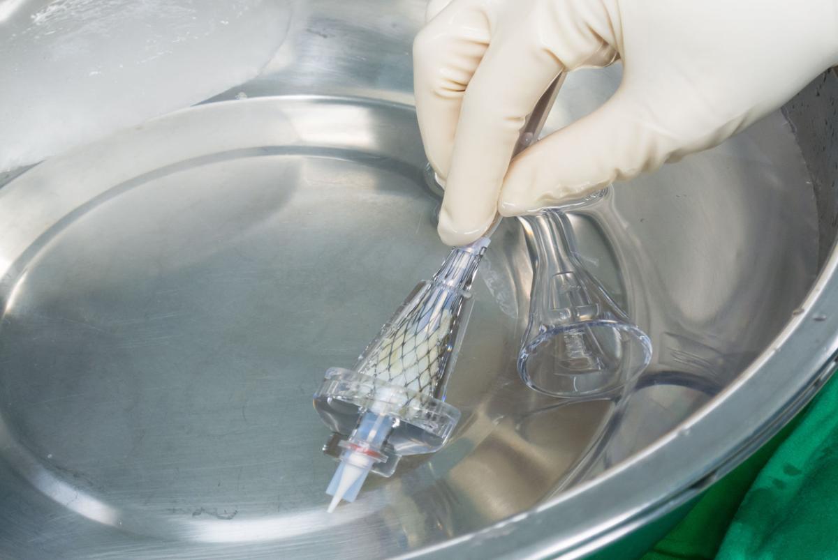Transcatheter aortic valve replacement