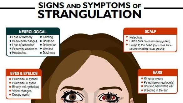Strangulation Injuries Law enforcement, medical officials discuss increase in strangulation ...