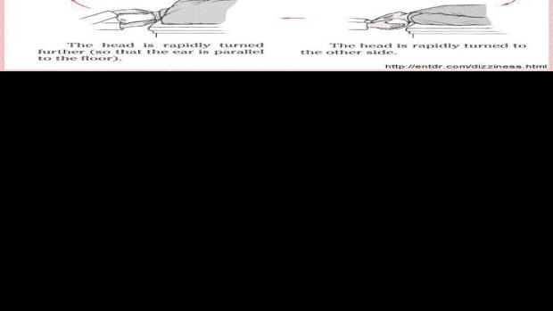 The Epley Maneuver | Local Offers | missoulian.com