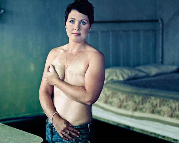 Breast cancer laid bare by photographer