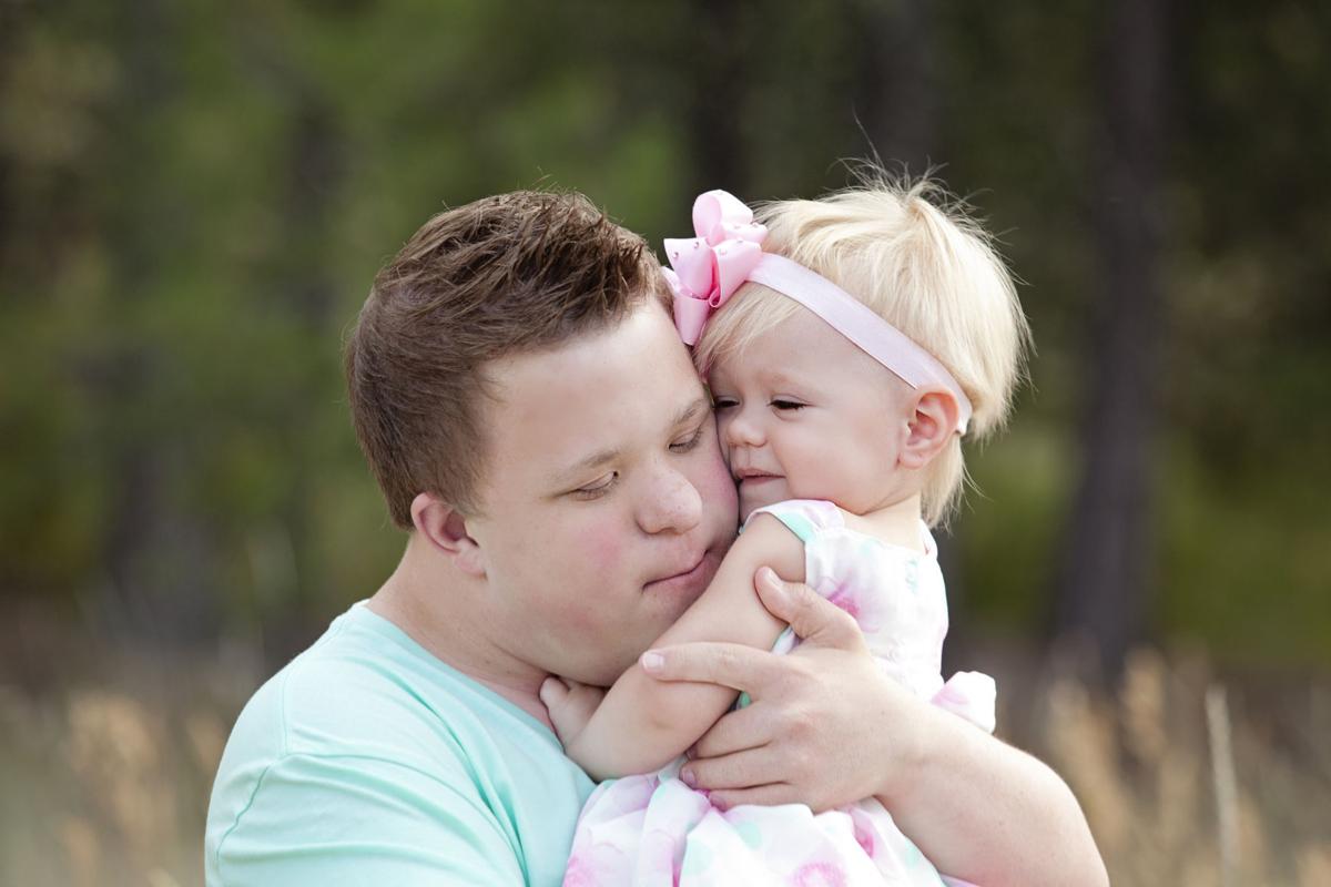 Down syndrome essays