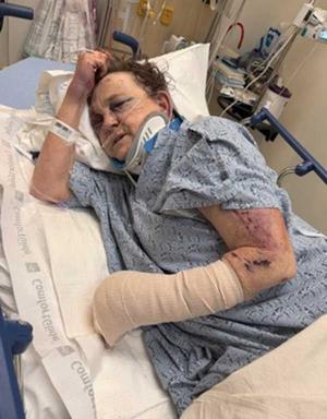 Brutal Bat Attack on Elderly Woman