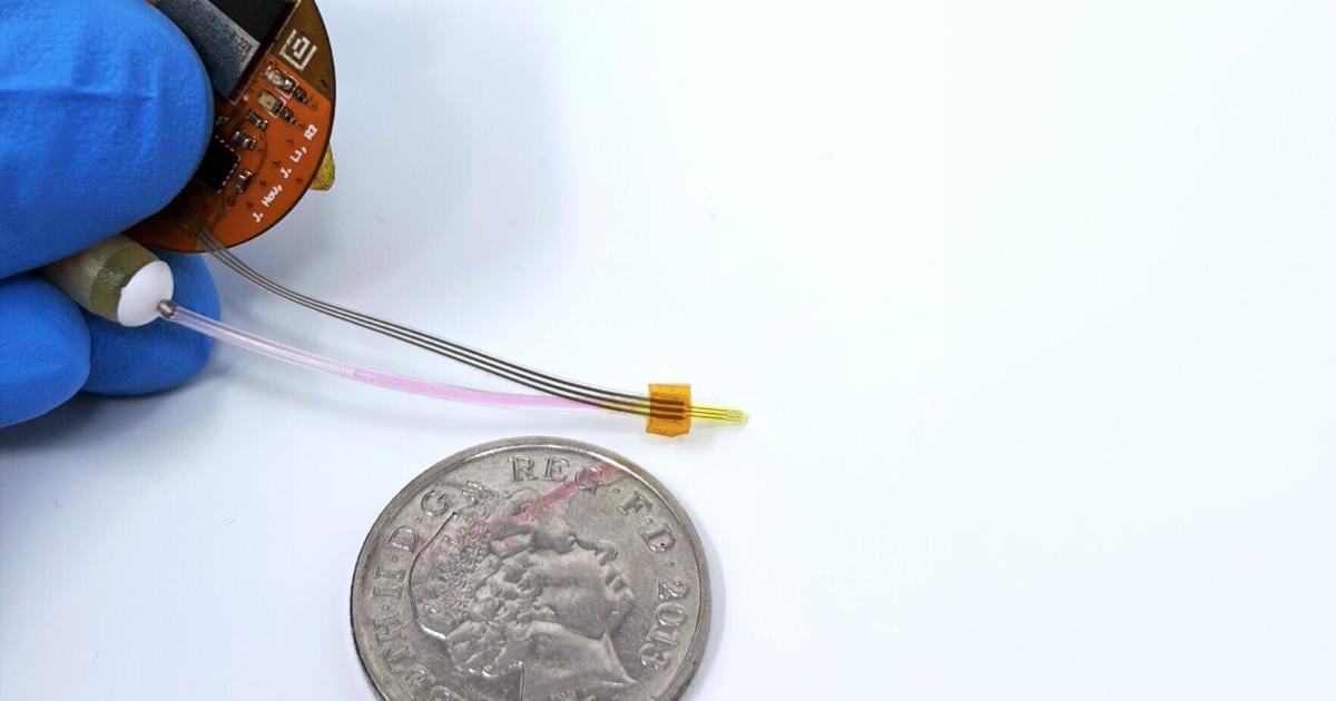 Happy Brain Spring MIT implant could stop deadly brain tumors from coming back | Health ...