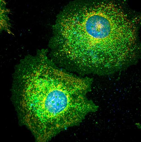 Scientists discover how tumors play dead to dodge chemotherapy | Health ...