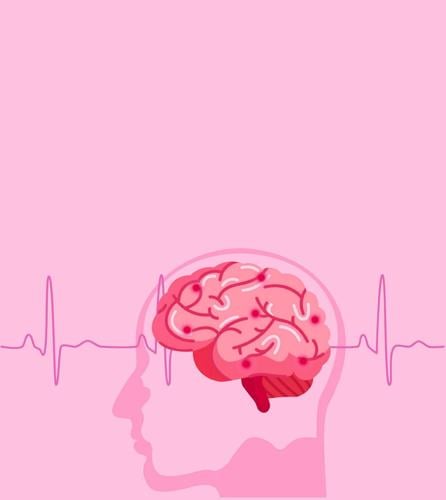 Health: Spotlight on Stroke