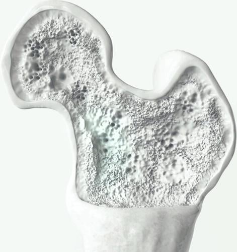 Health: Bone Up