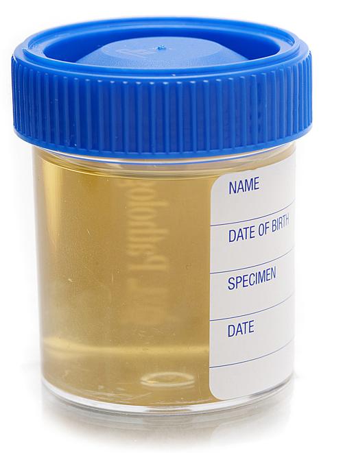 081914_Urine sample