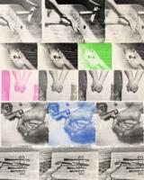 The Unexpected Symptoms of OCD