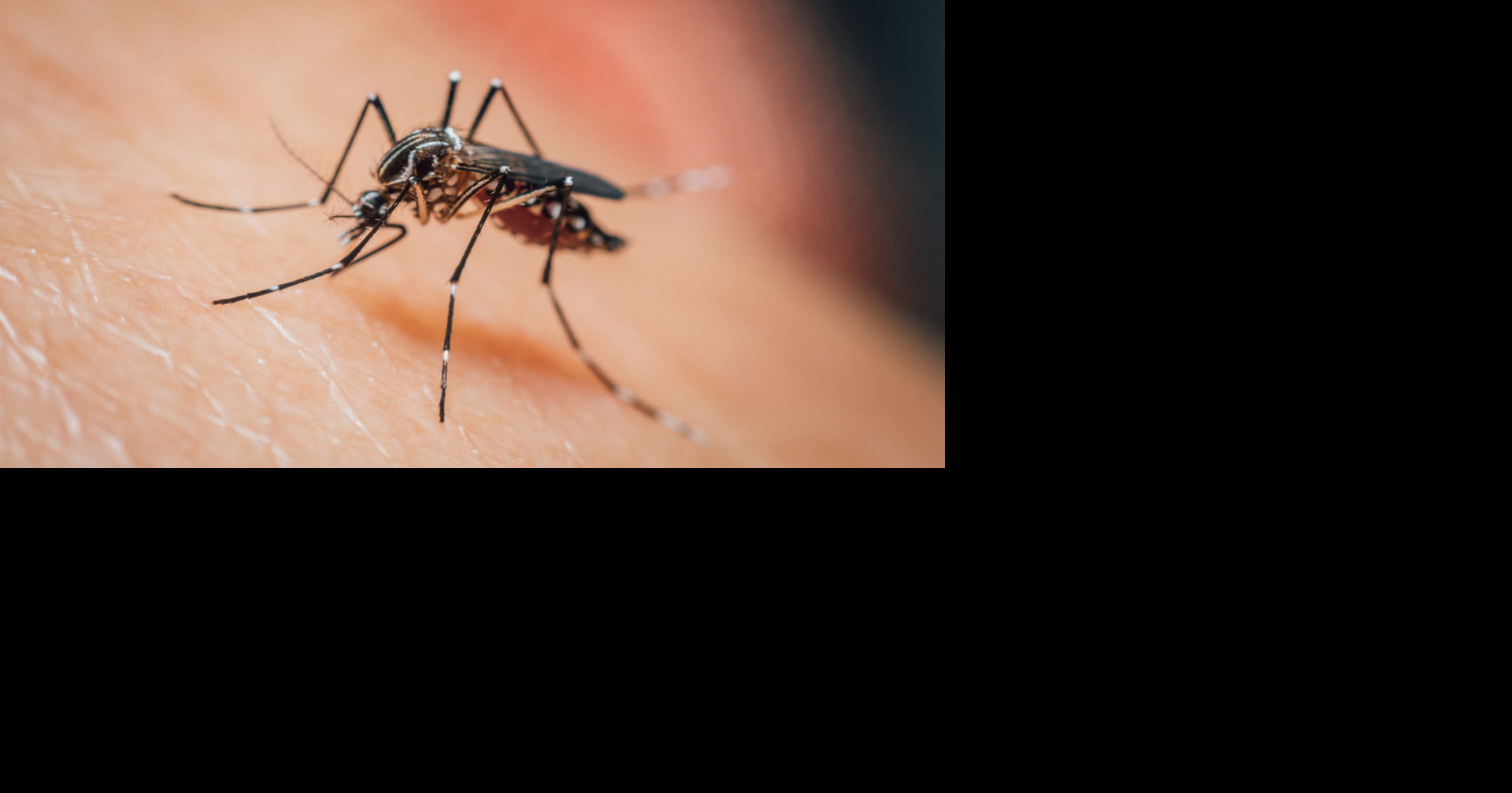 Michigan reports first human EEE case of 2026