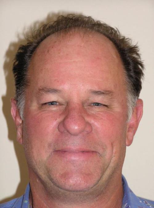 John D Newbold