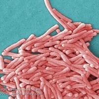 Napa County confirms Legionnaires’ disease cases at apartment complex