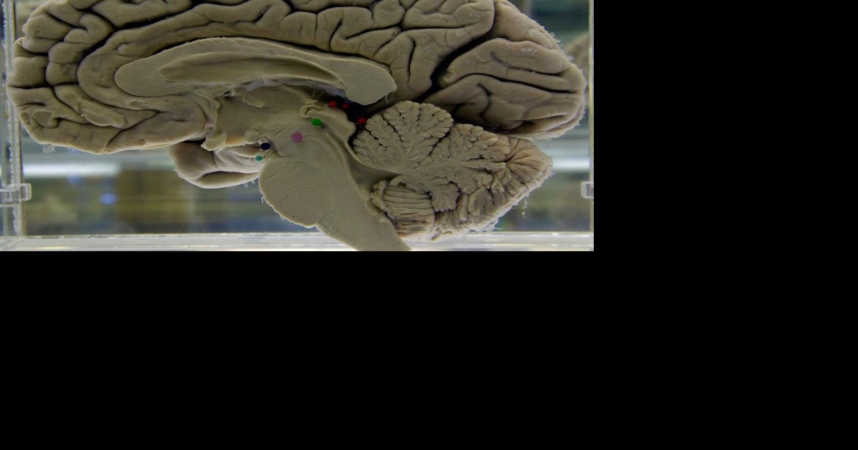 Stimuler son cerveau améliore la santé cognitive