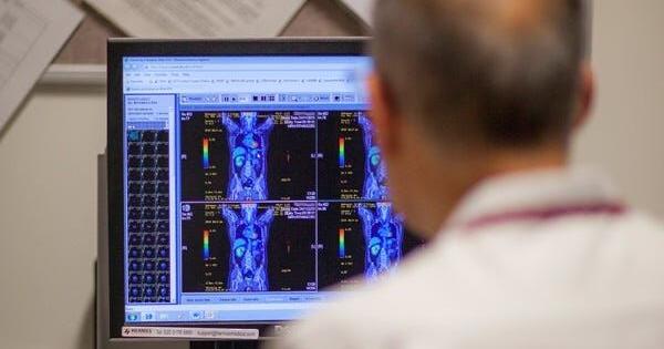 Axumin Scan Axumin PET scan aids in recurrent prostate cancer diagnosis | Features ...