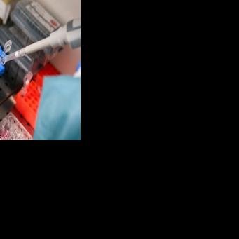 Researchers are finally making some progress in the fight against pancreatic cancer