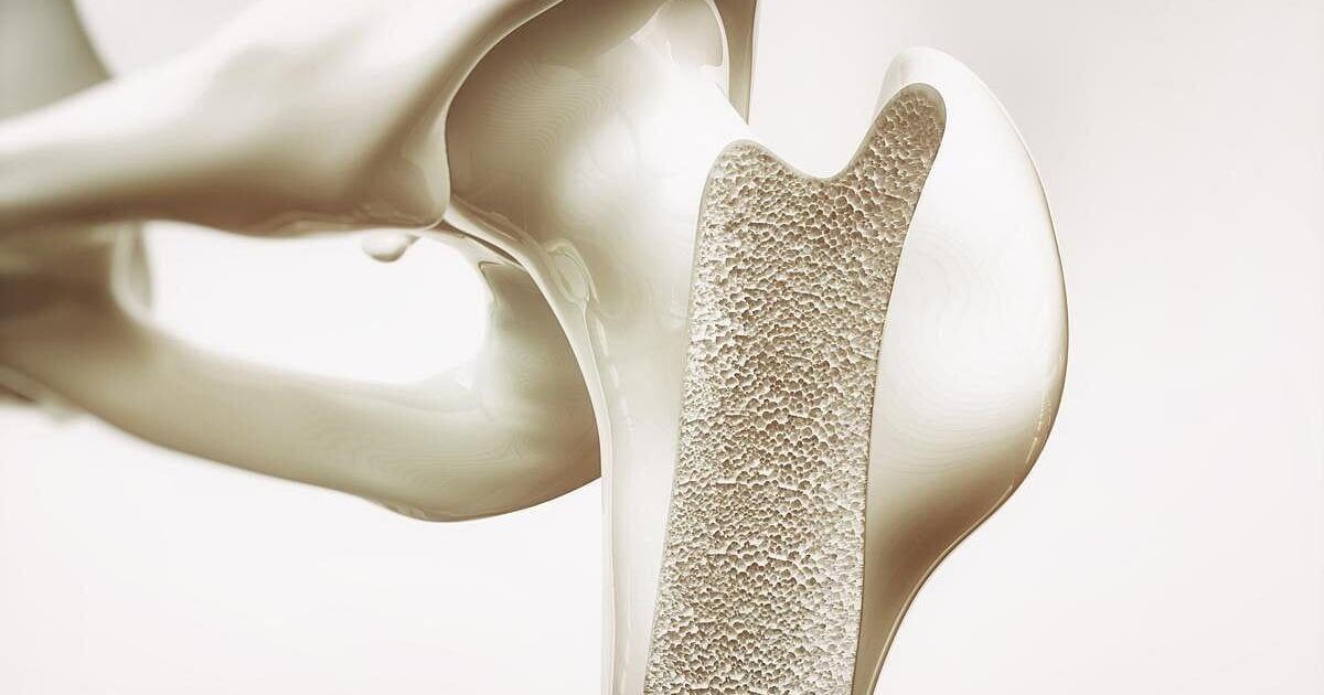 Weighted Vests Don’t Protect Bone Health In Dieting Seniors, Trial Says | Homes