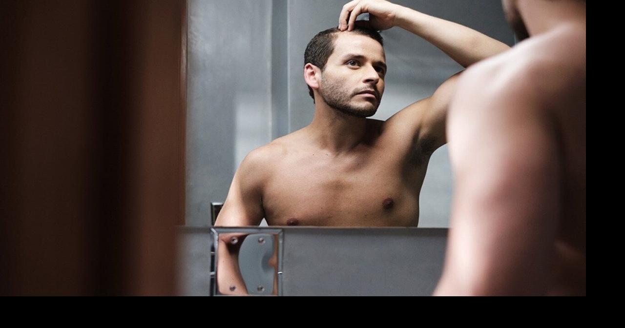 Baldest states: See how Wisconsin ranks for hair-loss medication prescriptions