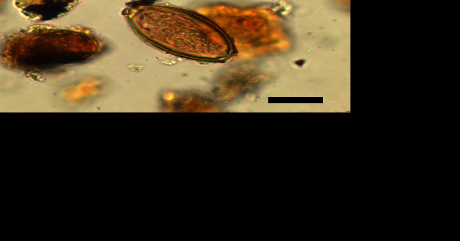 Research reveals Roman soldiers were plagued by gut parasites