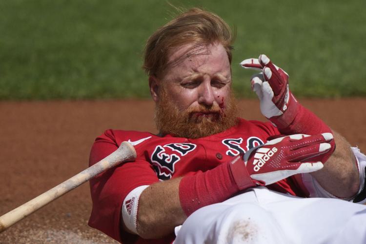 Justin Turner hit in head by pitch: Red Sox vet gets stitches, 'very  fortunate' after spring training accident 