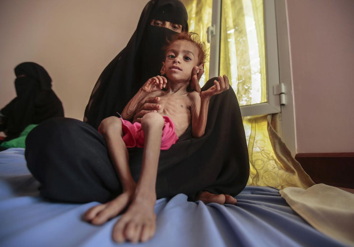 Image result for sad scenes from Yemen